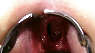 Luptă în pat a războ ...