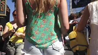 Orificiu anal tras.  ...